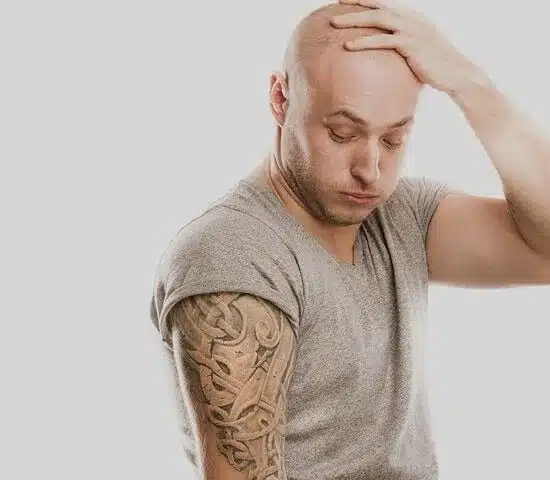 Everything you need to know about laser tattoo removal