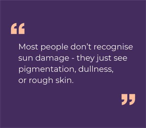 Sun damage is a common concern. How do you treat it?