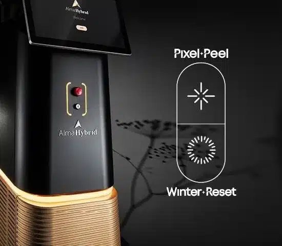 How Alma Hybrid Supports Structured Resurfacing