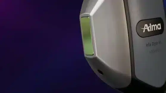Alma’s IPL technology